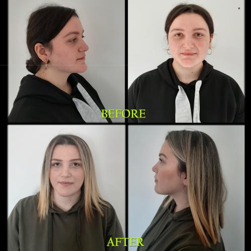 fotos antes y después de nuestros pacientes 1